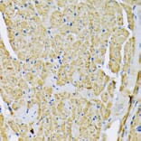 Immunohistochemistry - Anti-Hexokinase II Antibody (A12752) - Antibodies.com