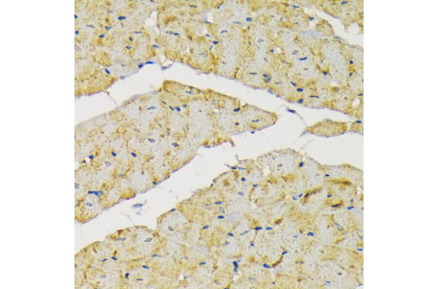 Immunohistochemistry - Anti-Hexokinase II Antibody (A12752) - Antibodies.com