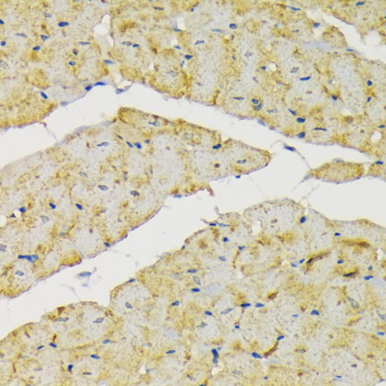 Immunohistochemistry - Anti-Hexokinase II Antibody (A12752) - Antibodies.com