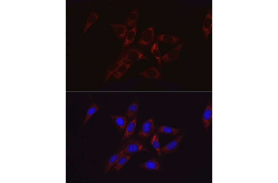 Immunofluorescence - Anti-Hexokinase II Antibody (A12752) - Antibodies.com