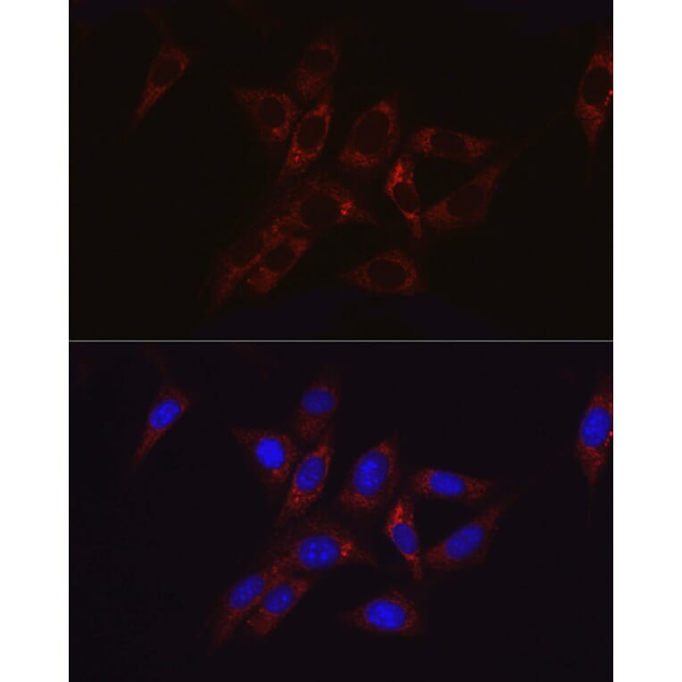 Immunofluorescence - Anti-Hexokinase II Antibody (A12752) - Antibodies.com