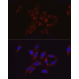 Immunofluorescence - Anti-Hexokinase II Antibody (A12752) - Antibodies.com