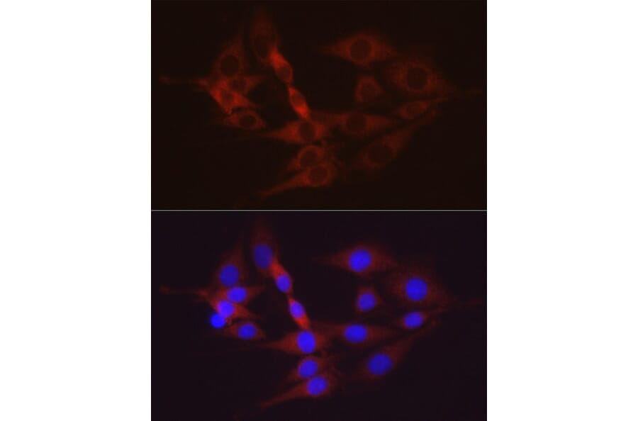 Immunofluorescence - Anti-Hexokinase II Antibody (A12752) - Antibodies.com
