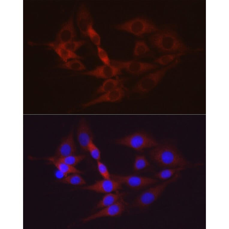 Immunofluorescence - Anti-Hexokinase II Antibody (A12752) - Antibodies.com