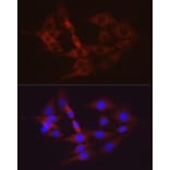 Immunofluorescence - Anti-Hexokinase II Antibody (A12752) - Antibodies.com