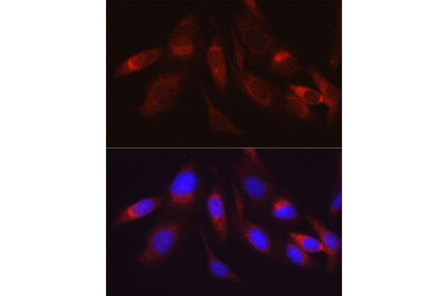 Immunofluorescence - Anti-Hexokinase II Antibody (A12752) - Antibodies.com