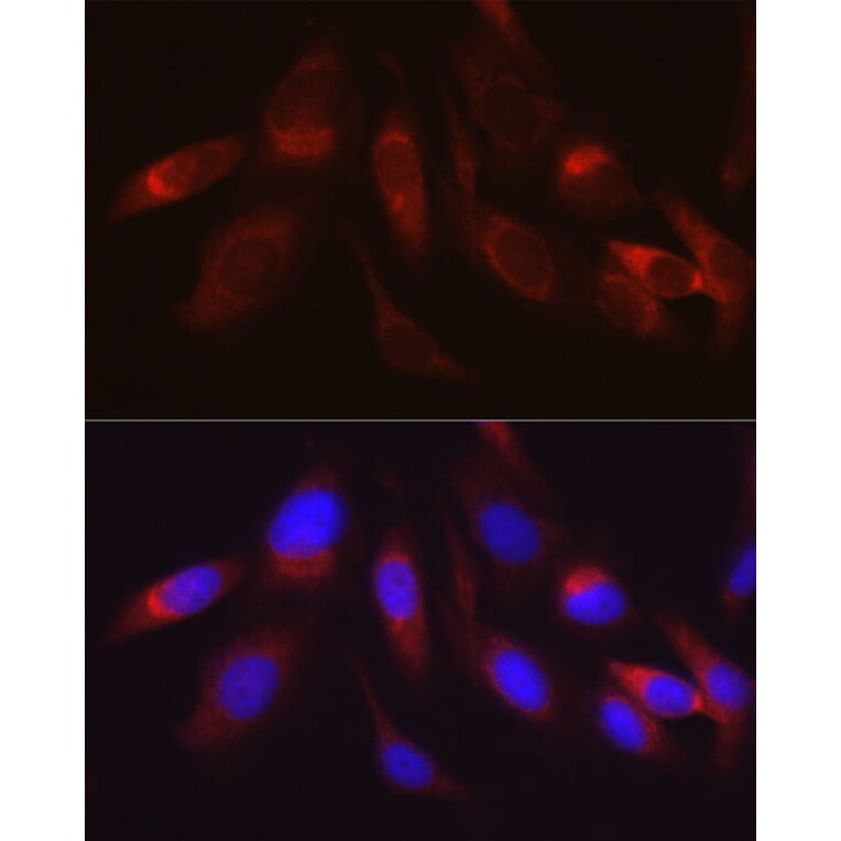 Immunofluorescence - Anti-Hexokinase II Antibody (A12752) - Antibodies.com