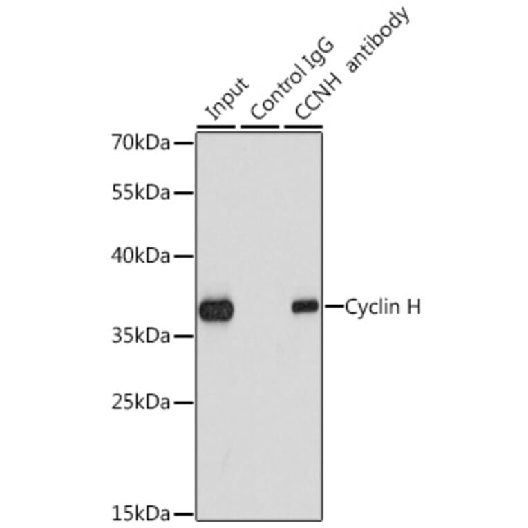 Western Blot - Anti-Cyclin H/p34 Antibody (A12753) - Antibodies.com