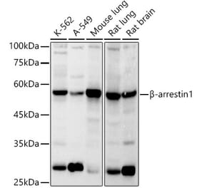 Western Blot - Anti-beta Arrestin 1 Antibody (A12755) - Antibodies.com