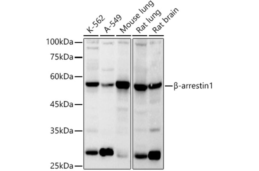 Western Blot - Anti-beta Arrestin 1 Antibody (A12755) - Antibodies.com