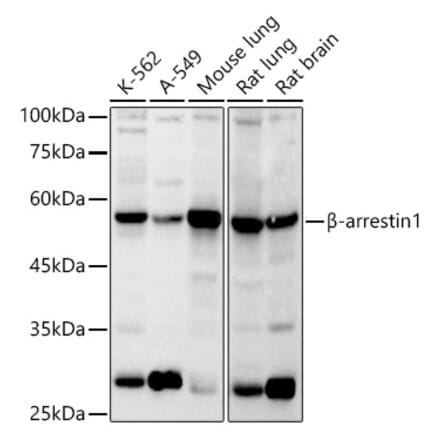 Western Blot - Anti-beta Arrestin 1 Antibody (A12755) - Antibodies.com