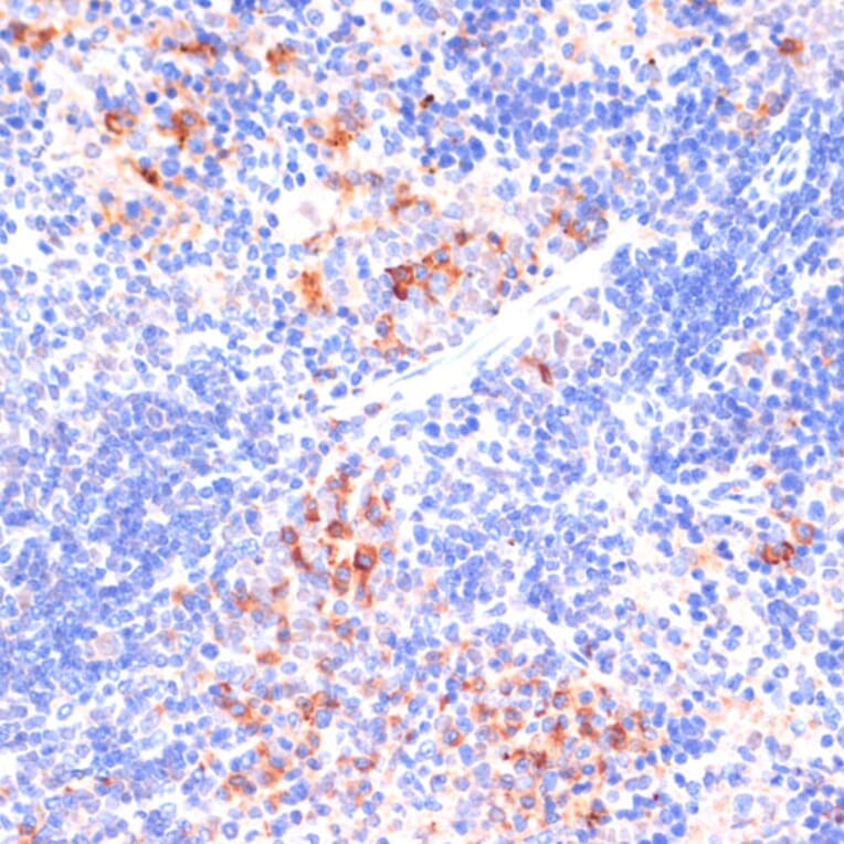 Immunohistochemistry - Anti-beta Arrestin 1 Antibody (A12755) - Antibodies.com