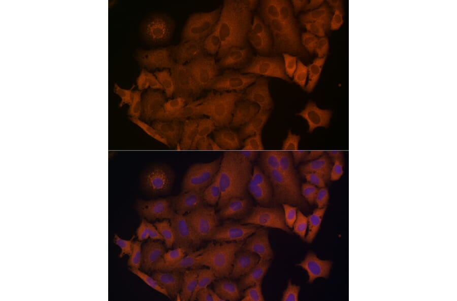 Immunofluorescence - Anti-beta Arrestin 1 Antibody (A12755) - Antibodies.com