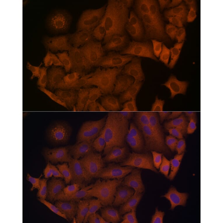 Immunofluorescence - Anti-beta Arrestin 1 Antibody (A12755) - Antibodies.com