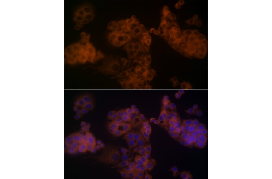 Immunofluorescence - Anti-beta Arrestin 1 Antibody (A12755) - Antibodies.com