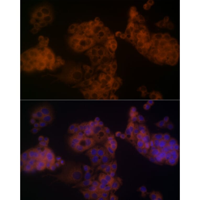 Immunofluorescence - Anti-beta Arrestin 1 Antibody (A12755) - Antibodies.com