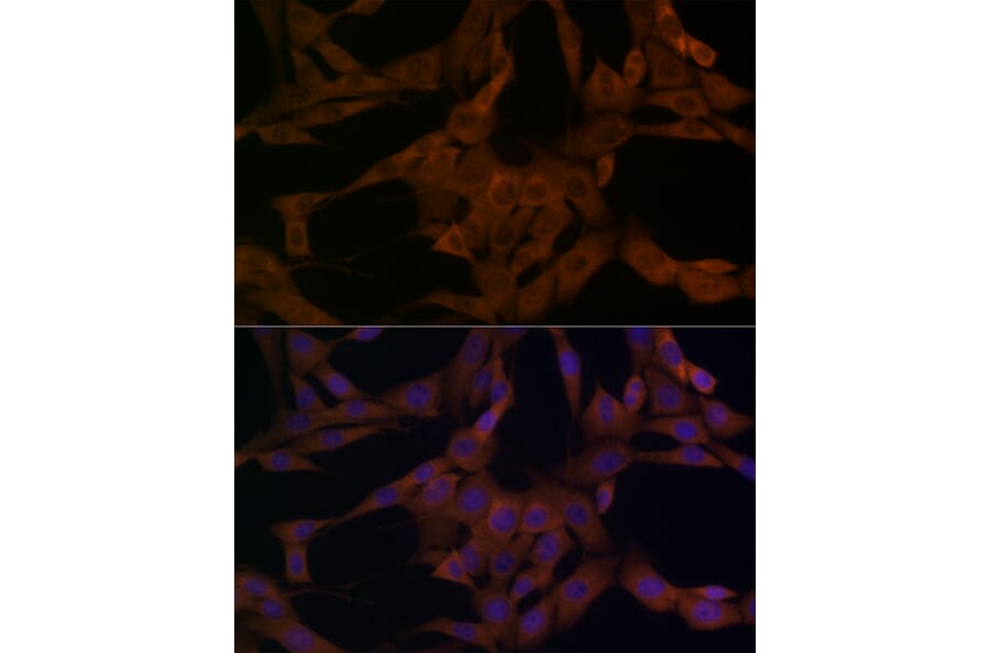 Immunofluorescence - Anti-beta Arrestin 1 Antibody (A12755) - Antibodies.com
