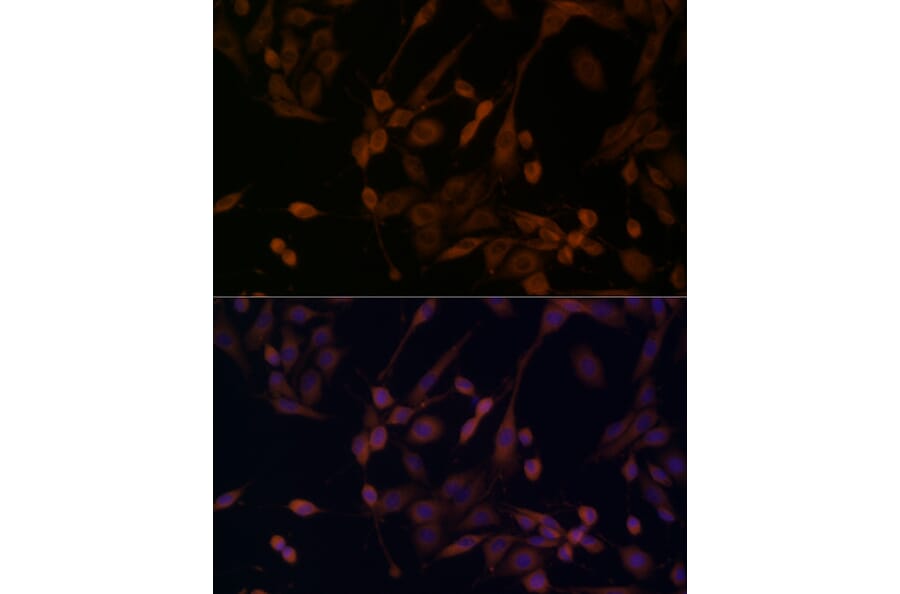 Immunofluorescence - Anti-beta Arrestin 1 Antibody (A12755) - Antibodies.com