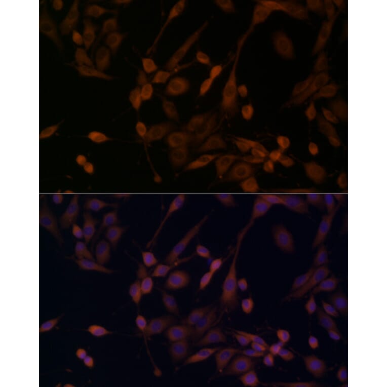Immunofluorescence - Anti-beta Arrestin 1 Antibody (A12755) - Antibodies.com