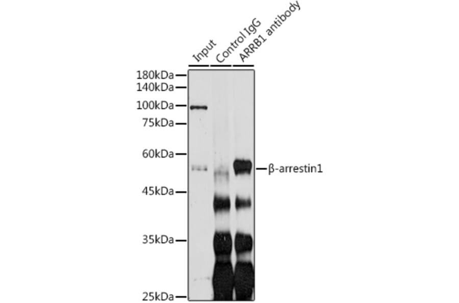 Western Blot - Anti-beta Arrestin 1 Antibody (A12755) - Antibodies.com