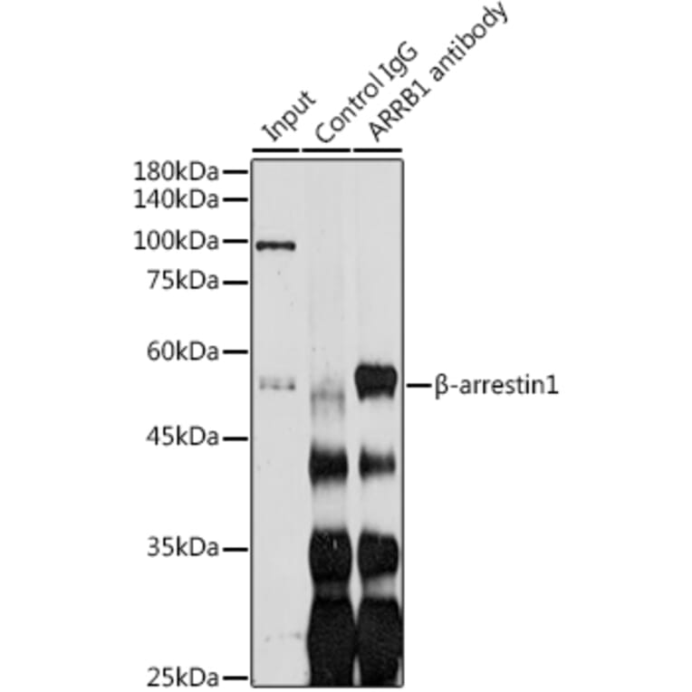 Western Blot - Anti-beta Arrestin 1 Antibody (A12755) - Antibodies.com