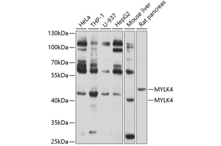 Western Blot - Anti-MYLK4 Antibody (A12757) - Antibodies.com