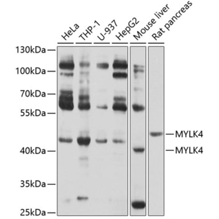 Western Blot - Anti-MYLK4 Antibody (A12757) - Antibodies.com