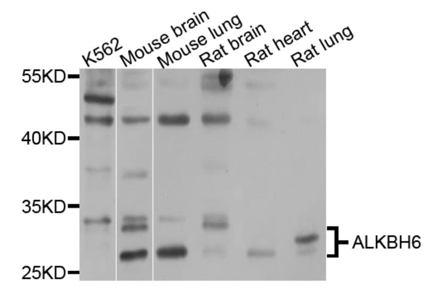 Western Blot - Anti-ALKBH6 Antibody (A10004) - Antibodies.com
