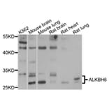 Western Blot - Anti-ALKBH6 Antibody (A10004) - Antibodies.com