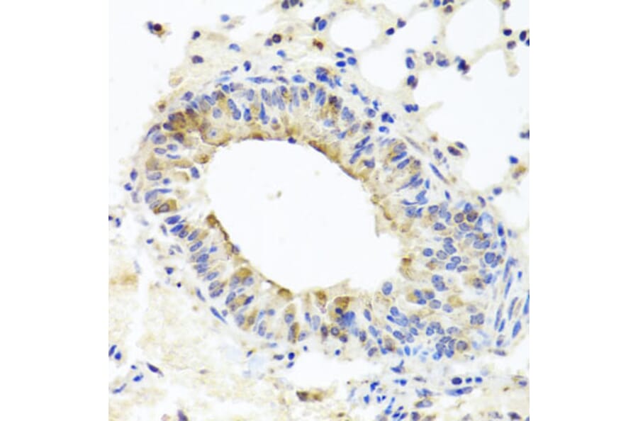 Immunohistochemistry - Anti-MUC16 Antibody (A10005) - Antibodies.com
