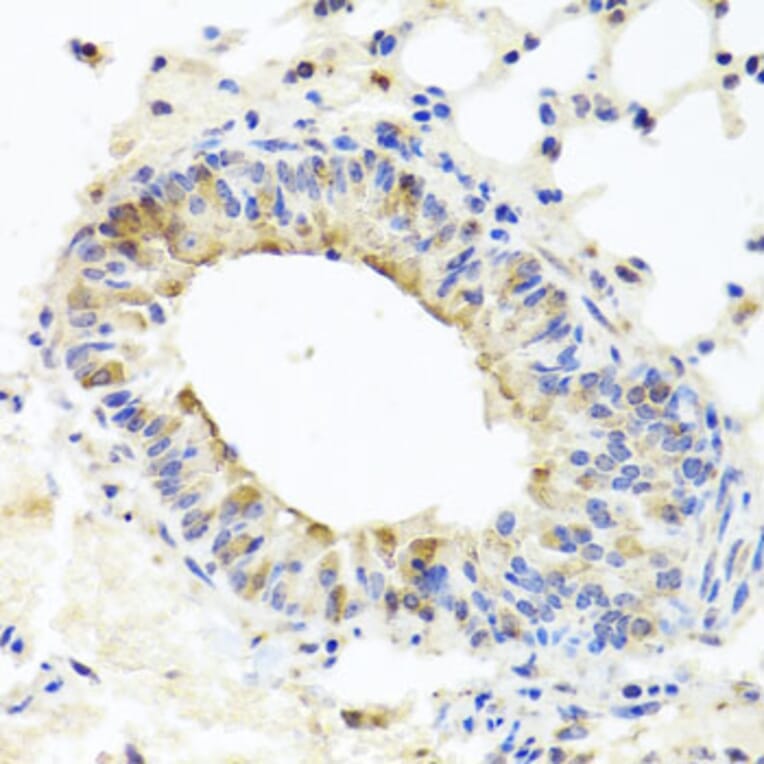 Immunohistochemistry - Anti-MUC16 Antibody (A10005) - Antibodies.com