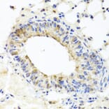 Immunohistochemistry - Anti-MUC16 Antibody (A10005) - Antibodies.com