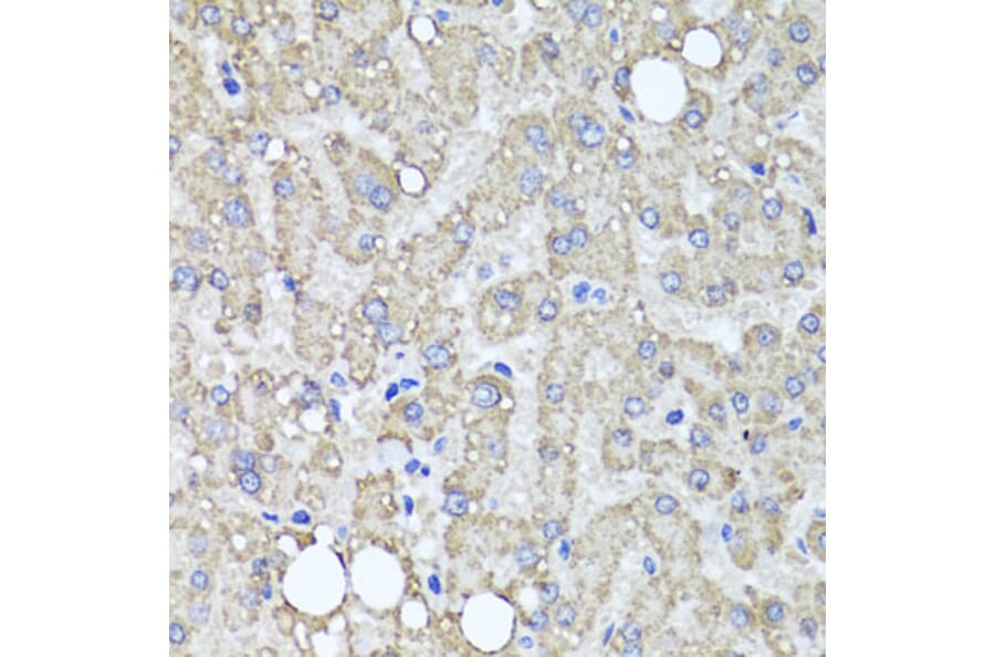 Immunohistochemistry - Anti-MUC16 Antibody (A10005) - Antibodies.com