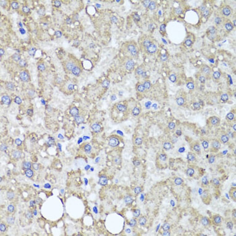 Immunohistochemistry - Anti-MUC16 Antibody (A10005) - Antibodies.com