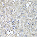 Immunohistochemistry - Anti-MUC16 Antibody (A10005) - Antibodies.com