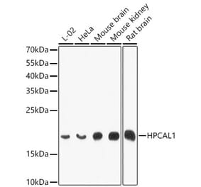 Western Blot - Anti-VILIP3 Antibody (A12761) - Antibodies.com