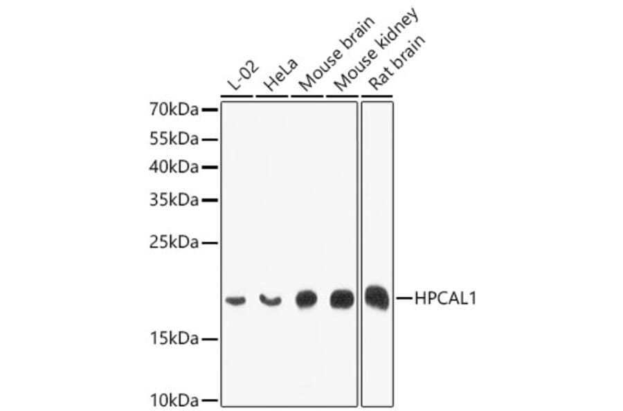 Western Blot - Anti-VILIP3 Antibody (A12761) - Antibodies.com