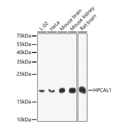 Western Blot - Anti-VILIP3 Antibody (A12761) - Antibodies.com