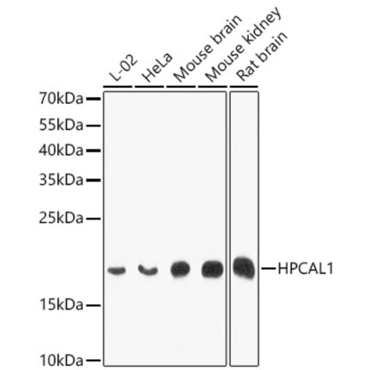 Western Blot - Anti-VILIP3 Antibody (A12761) - Antibodies.com