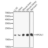 Western Blot - Anti-VILIP3 Antibody (A12761) - Antibodies.com