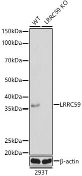 Western blot analysis of extracts of various cell lines, using Anti-LRRC59 Antibody (A10022) at 1:1,000 dilution.
Secondary antibody: Goat Anti-Rabbit IgG (H+L) (HRP) (AS014) at 1:10,000 dilution.
Lysates / proteins: 25µg per lane.
Blocking buffer: 3% non-fat dry milk in TBST.
Detection: ECL Basic Kit (RM00020).
Exposure time: 5s.