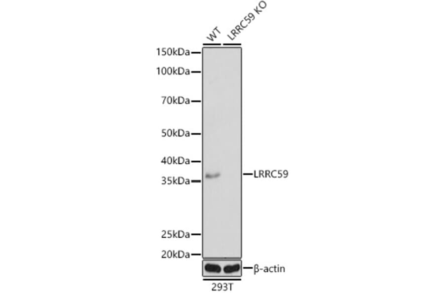 Western Blot - Anti-LRRC59 Antibody (A12762) - Antibodies.com