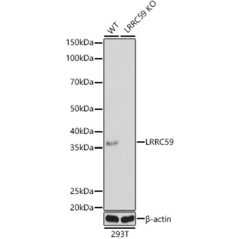 Western Blot - Anti-LRRC59 Antibody (A12762) - Antibodies.com