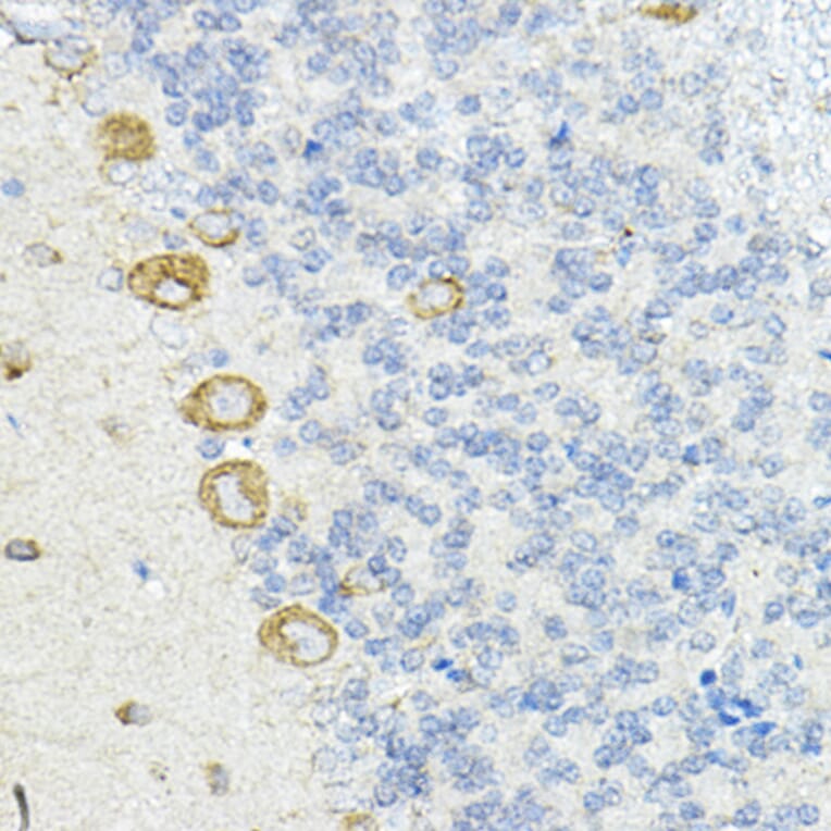 Immunohistochemistry - Anti-LRRC59 Antibody (A12762) - Antibodies.com