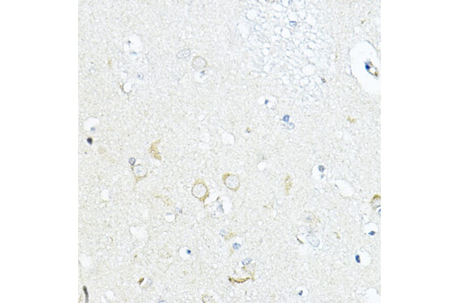 Immunohistochemistry - Anti-LRRC59 Antibody (A12762) - Antibodies.com