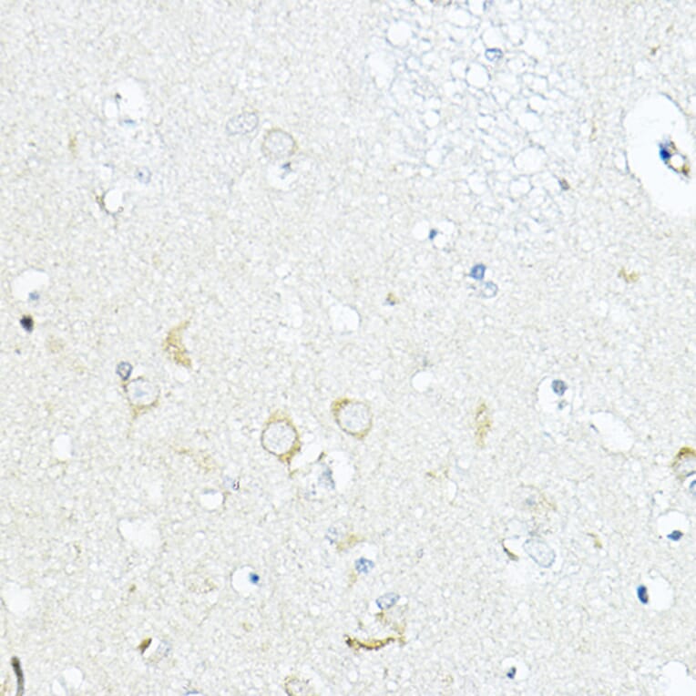 Immunohistochemistry - Anti-LRRC59 Antibody (A12762) - Antibodies.com
