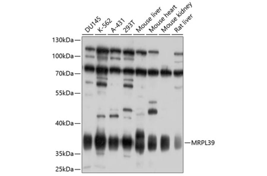 Western Blot - Anti-MRPL39 Antibody (A10023) - Antibodies.com