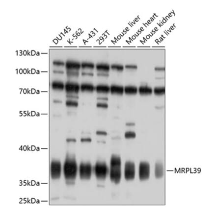 Western Blot - Anti-MRPL39 Antibody (A10023) - Antibodies.com