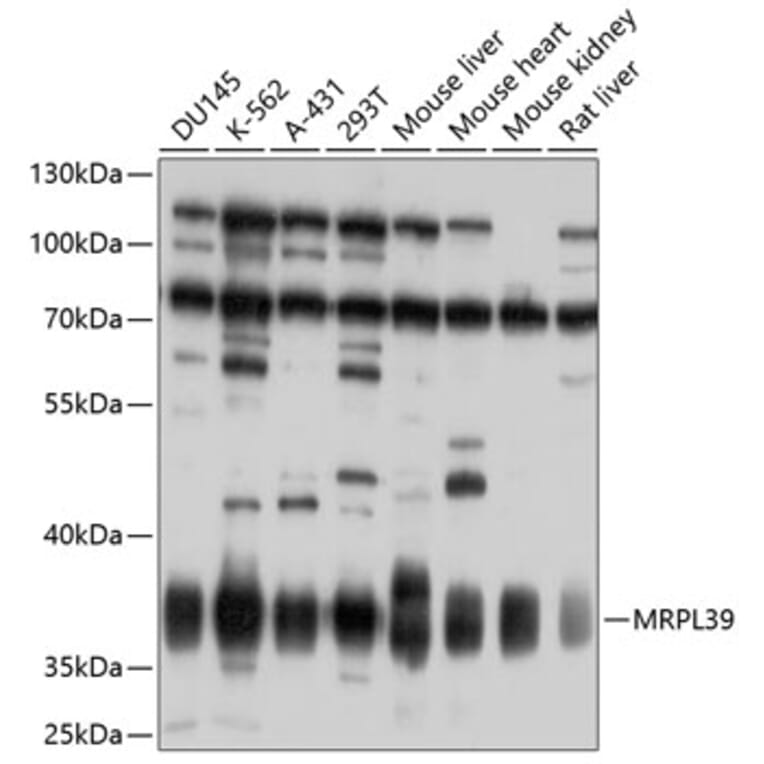 Western Blot - Anti-MRPL39 Antibody (A10023) - Antibodies.com