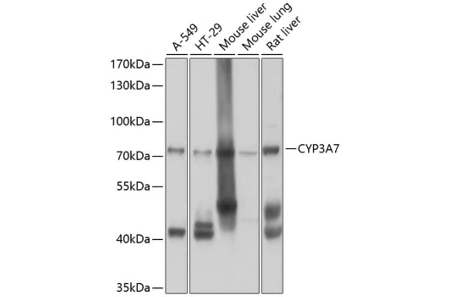 Western Blot - Anti-CYP3A7 Antibody (A10026) - Antibodies.com